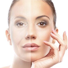 Avivencia de la piel facial