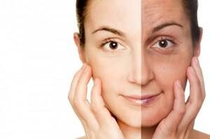 Rejuvenecer
